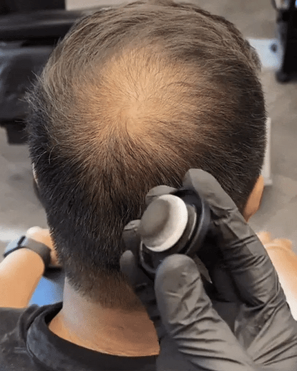 Hairline Powder
