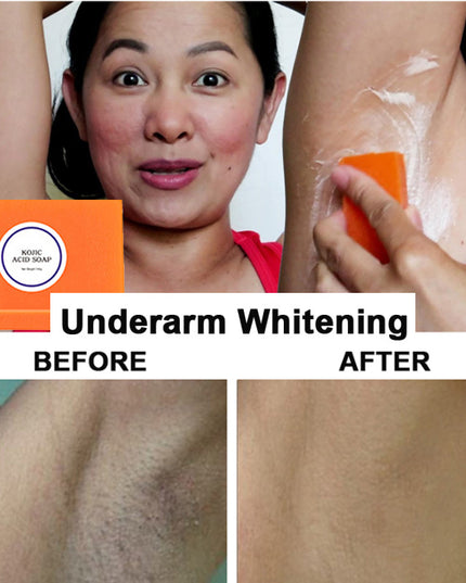 Cleansing Acne Removing Mites Moisturizing And Brightening Soap